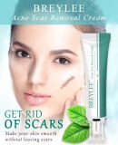 Breylee Acne Scar Removal Cream In Pakistan